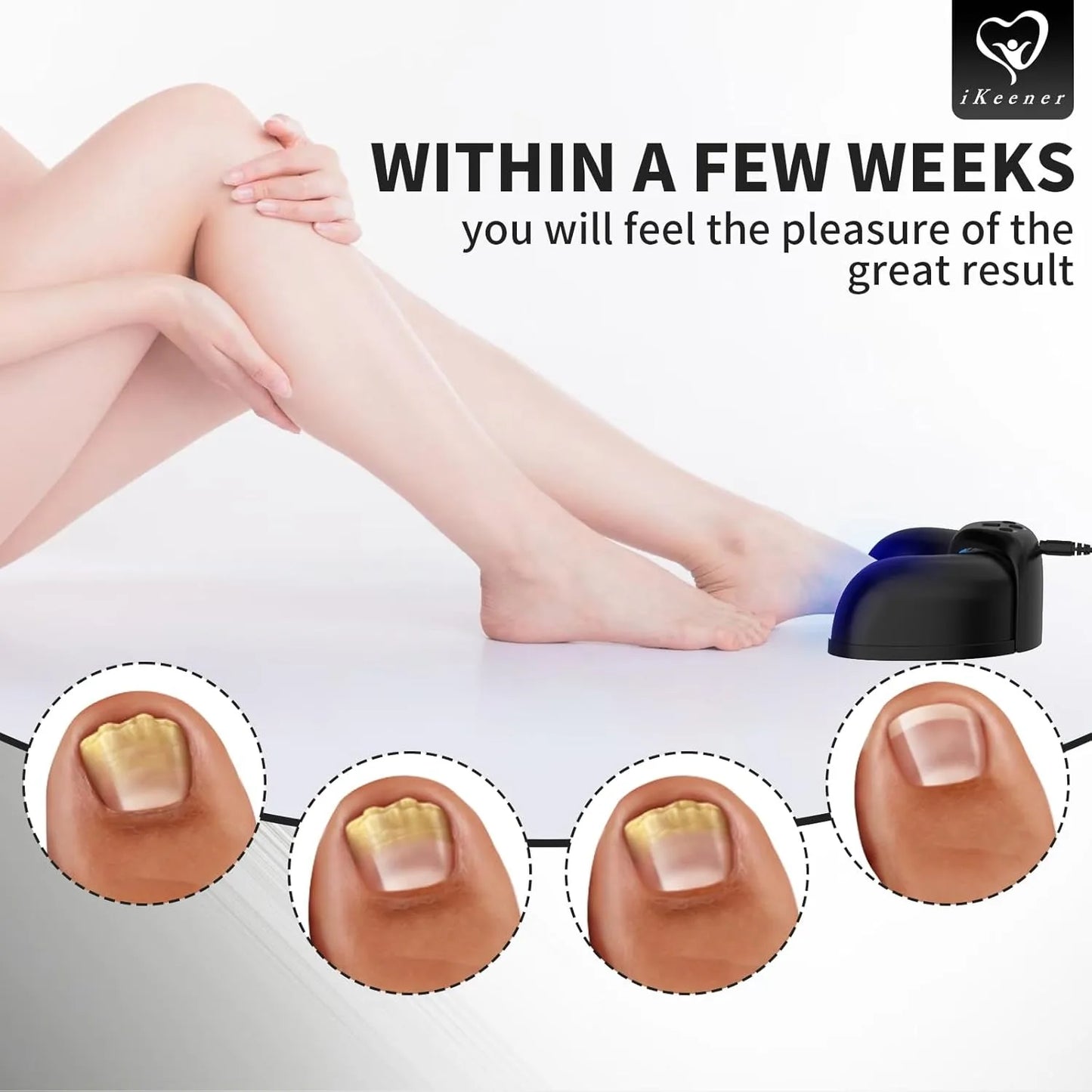 Nail Fungus Laser Device Onychomycosis Treatment