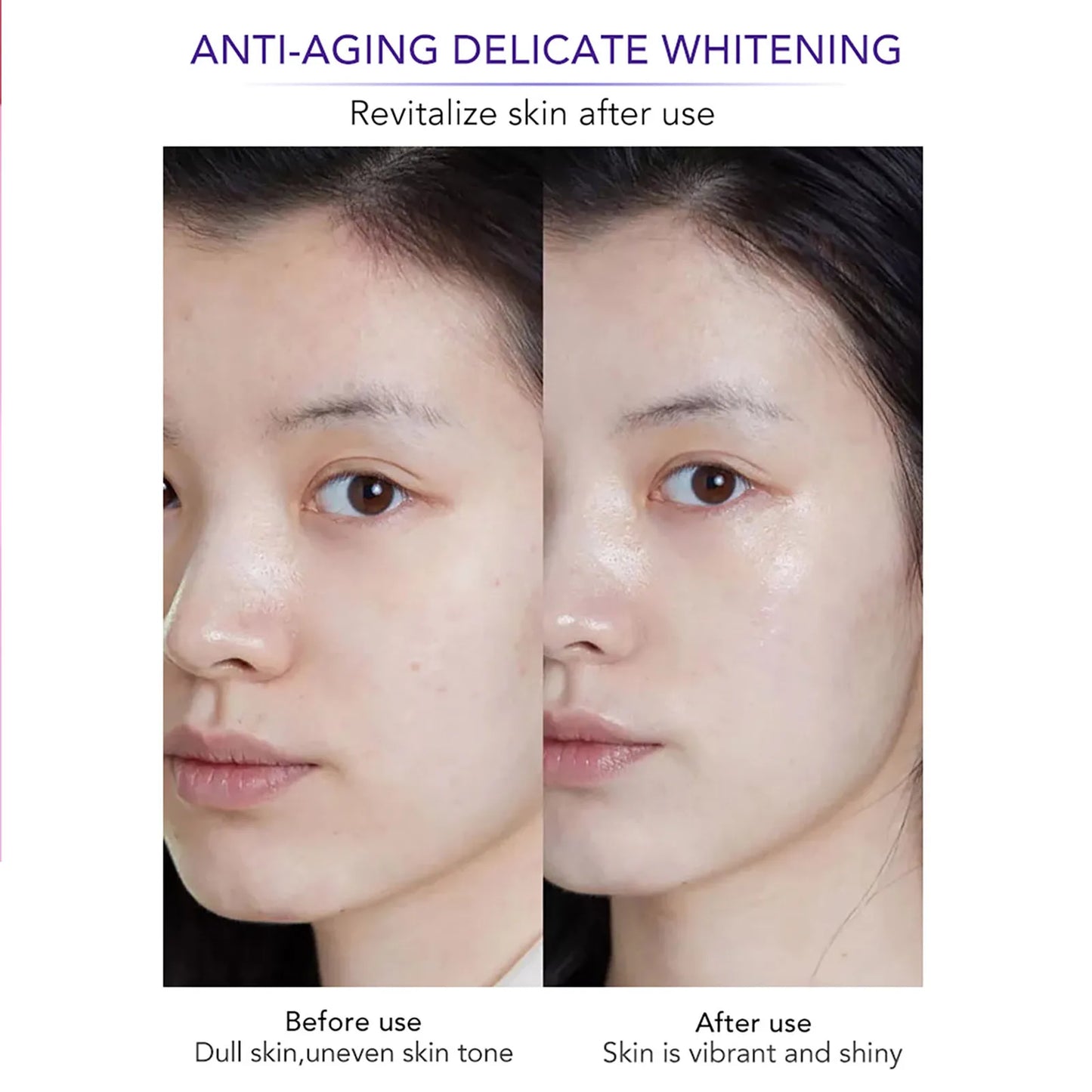 KYLIEFIT Whitening Anti-Wrinkle Freckle Face Cream With Collagen Hyaluronic Acid