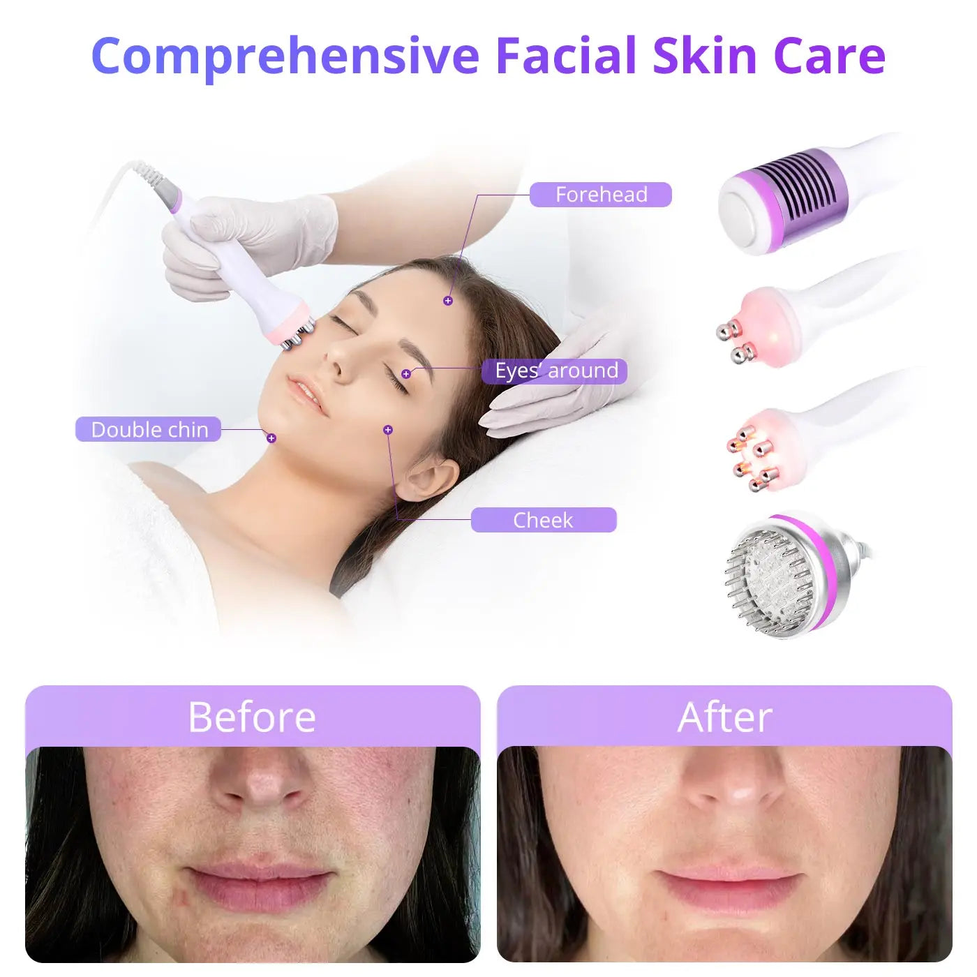 MYCHWAY Cavitation 40K Machine for Skin Tightening and Facial Stimulation