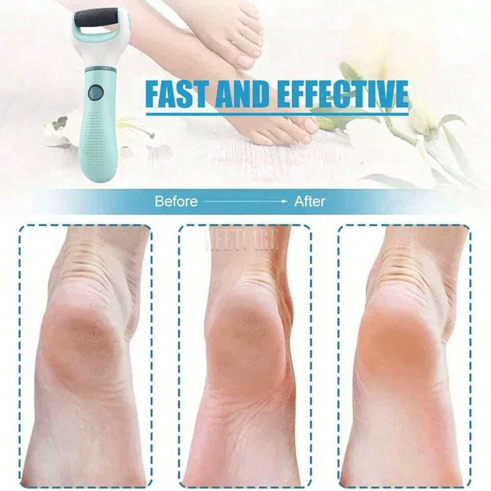 Foot File Callus Remover For Dead Skin Foot Care Tool